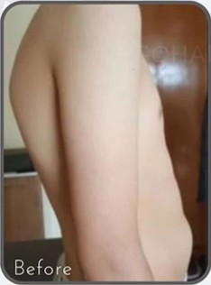 قبل از درمان