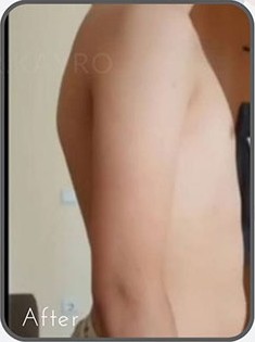 قبل از درمان