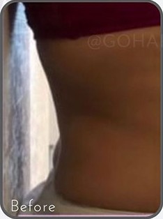 قبل از درمان