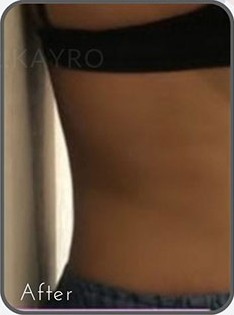 قبل از درمان