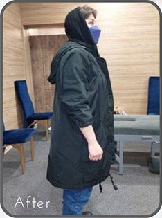 قبل از درمان